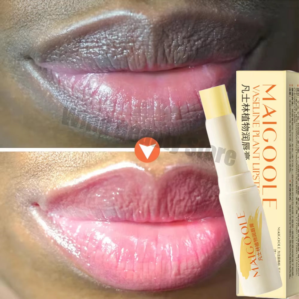 Fast Lightening Pink Mouth Lips Serum Bleaching Permanent Pinkish Moisturizing Lighten Dark Lip Balm Gloss Lipstick Lip Mask