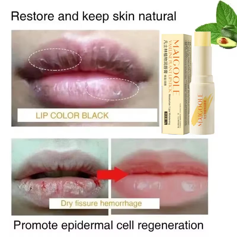 Fast Lightening Pink Mouth Lips Serum Bleaching Permanent Pinkish Moisturizing Lighten Dark Lip Balm Gloss Lipstick Lip Mask