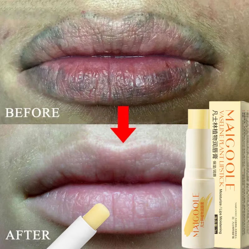 Fast Lightening Pink Mouth Lips Serum Bleaching Permanent Pinkish Moisturizing Lighten Dark Lip Balm Gloss Lipstick Lip Mask
