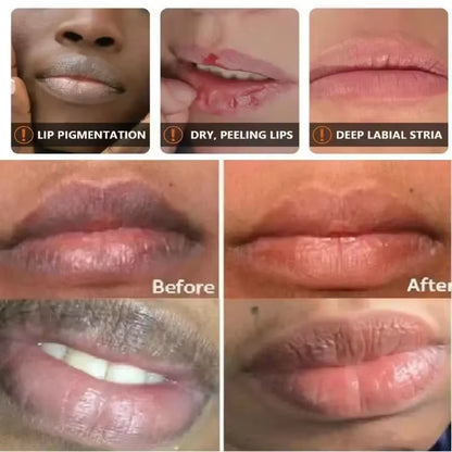 Fast Lightening Pink Mouth Lips Serum Bleaching Permanent Pinkish Moisturizing Lighten Dark Lip Balm Gloss Lipstick Lip Mask