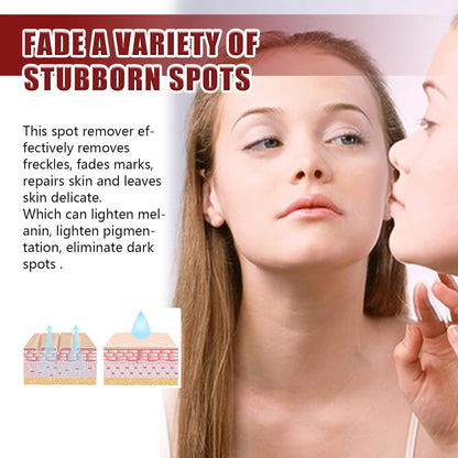 Whitening Spot Lightening Cream Lighten Spot Skin Cream Moisturizing Repair Skin Cream Brighten Skin Tone Brightening and Exfoliating Gentle Facial Cream