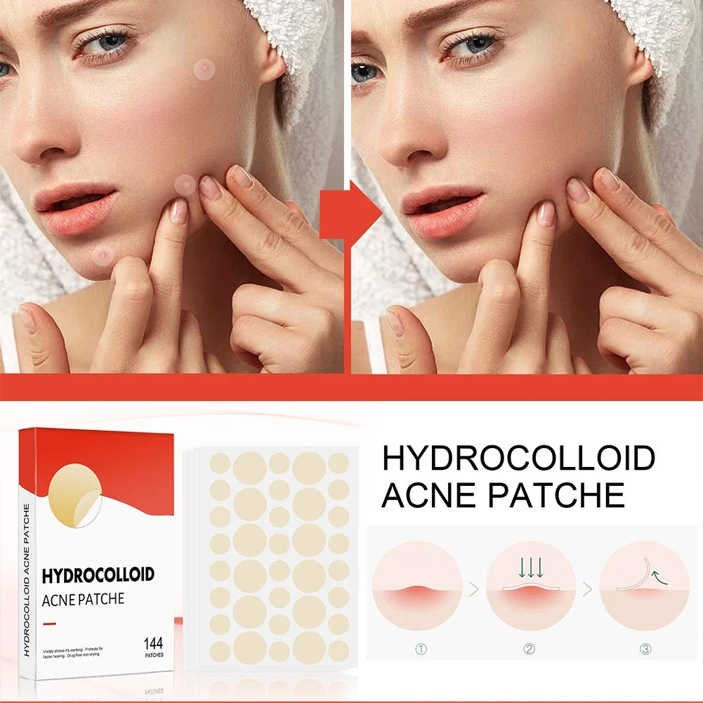 144Pcs/Set Face Skin Care Acne Pimple Patch 2 Sizes Invisible Professional Healing Absorbing Spot Sticker Covering for Men Women
